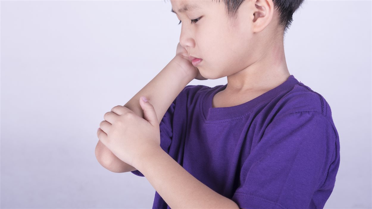 L'arthrite juvénile touche un nombre grandissant d'enfants