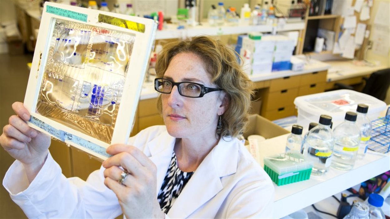 Caroline Cameron, microbiologiste de l'Université de Victoria, travaille à développer un vaccin contre la syphilis.