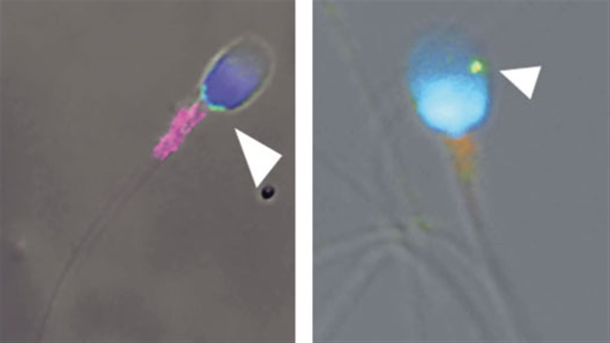 Spermatozoïdes infectés par le virus Zika (visible en vert; fléché)