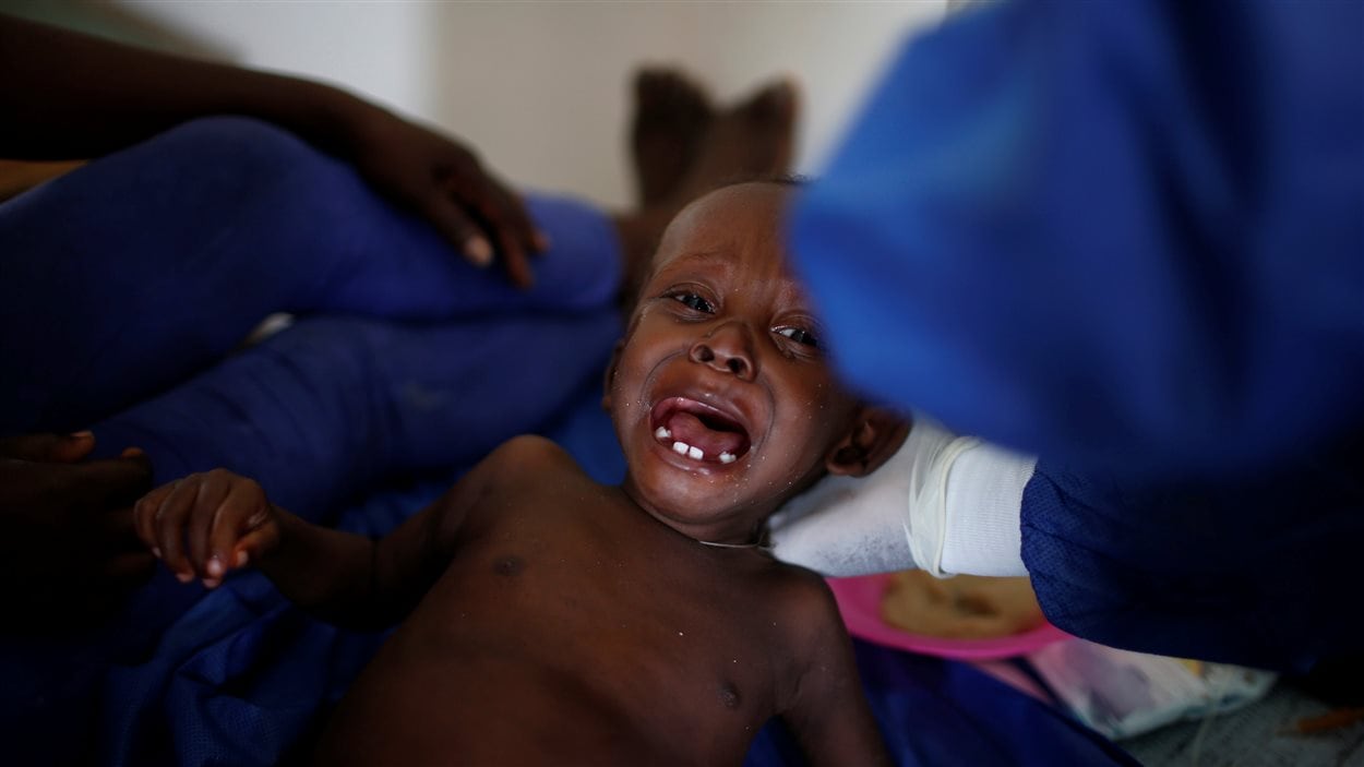 Un enfant pleure dans un centre du traitement du choléra à Jérémie, en Haïti, après le passage de l'ouragan Matthew.