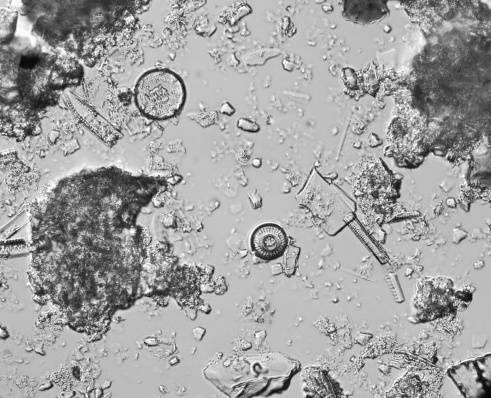 Discostella stelligera, une espèce de diatomée.