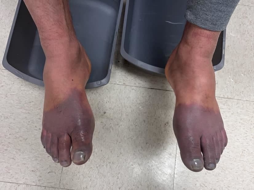 Les pieds d'un migrant